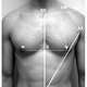 Illustration for article titled Divine Proportions in male nipple re-positioning